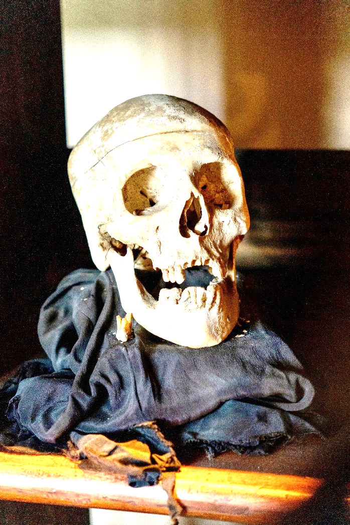 An over-exposed image of a skull